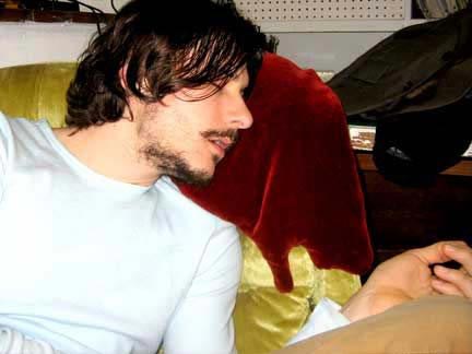 ��(chu��ng  )���OӋ��Ѫ���^��ɢѪ��